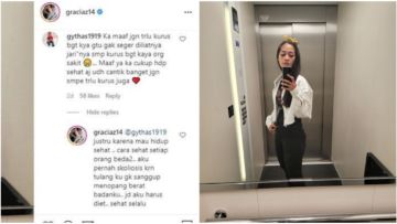 Dikritik Terlalu Kurus, Gracia Indri Ungkap Derita Skoliosis: Tulangku Nggak Kuat, Jadi Harus Diet