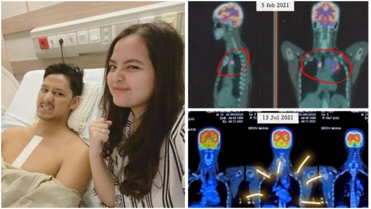 Randi Bachtiar Sembuh dari Kanker Getah Bening, Tasya Kamila Diliputi Rasa Syukur Sekaligus Haru