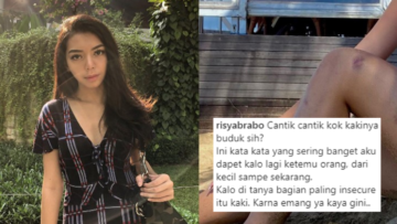 Kaki Banyak Luka Dibilang Budukan, Selebgram Risya Brabo: Nggak Ada yang Salah dengan itu