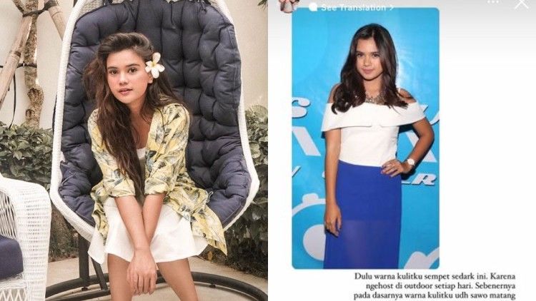 Pernah Dibilang “Burik” oleh Rekan Artis, Audi Marissa: Kulit Gelap Bukan Hal yang Harus Direndahkan