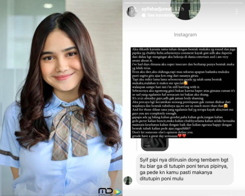 Diminta Tiruskan Pipi, Syifa Hadju: Kecantikan Perempuan Gak Cuma Diukur dari Wajahnya