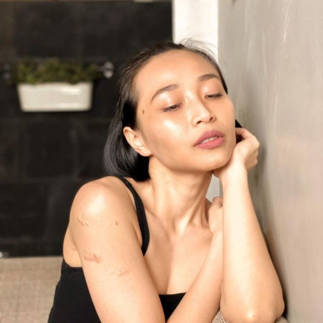 Artis Perempuan Indonesia yang Gaungkan Body Positivity. Serukan Penerimaan Diri