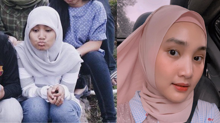 Foto Deretan Penyanyi Saat SMA vs Sekarang. Gemes Banget!