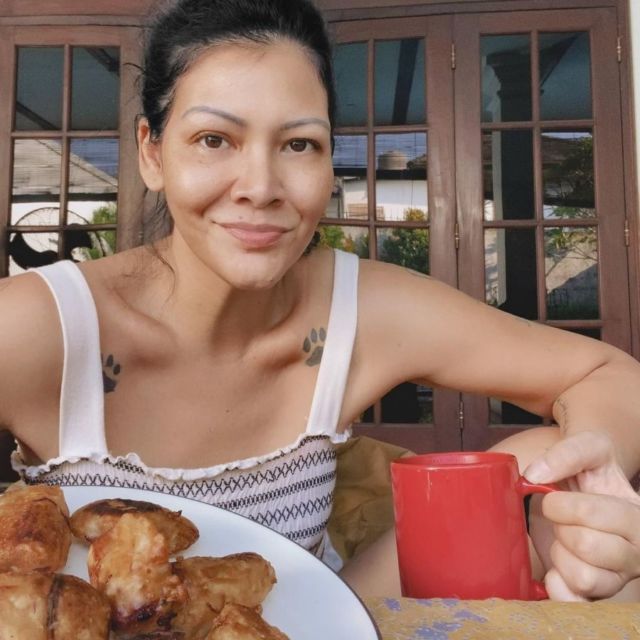 Melanie Subono Jalani Operasi Akibat Pecah Tumor, Ternyata Sudah Idap Puluhan Tahun