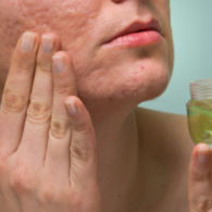 6 Cara Menghilangkan Bekas Jerawat Hitam di Pipi dengan Masker Alami