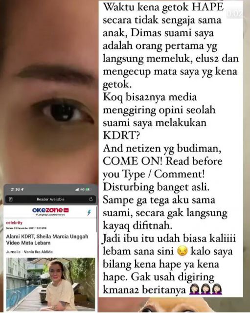 Sheila Marcia Bantah Dugaan KDRT Setelah Unggah Foto Wajah Lebam