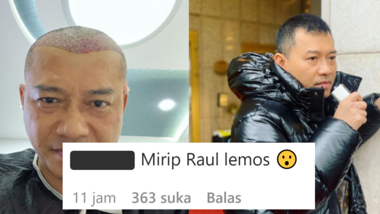 Anang Hermansyah Disebut Mirip Raul Lemos Usai Tampil Botak