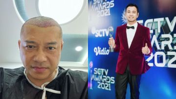 12 Artis yang Pernah Lakukan Transplantasi Rambut. Siapa Saja?