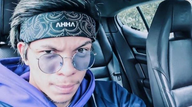 Atta Halilintar Lelang Headband Usai Transplantasi Rambut, Alasannya Mulia!