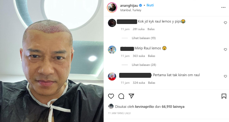 Anang Hermansyah Disebut Mirip Raul Lemos Usai Tampil Botak