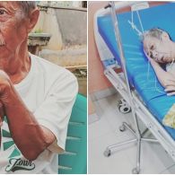 Pak Ogah Alami Penyumbatan Pembuluh Darah di Otak dan Batu Empedu