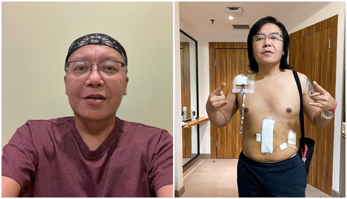 Ari Lasso Sembuh dari Kanker Usai Jalani 6 Sesi Kemoterapi