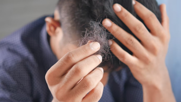 5 Rekomendasi Penumbuh Rambut untuk Atasi Kebotakan Dini