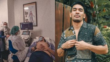 Tumor Payudara Robby Purba Aktif Lagi Usal 3 Bulan Jalani Operasi