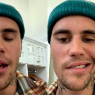 Justin Bieber Kena Sindrom Langka Ramsay Hunt, Wajahnya Lumpuh Sebelah