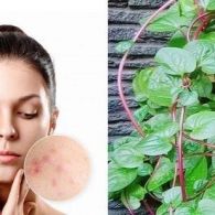 Mengenal Tanaman Herbal Binahong dan Manfaatnya Sebagai Penyembuh Jerawat