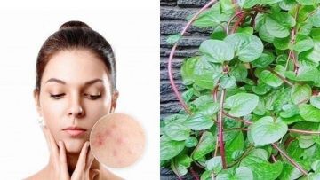 Mengenal Tanaman Herbal Binahong dan Manfaatnya Sebagai Penyembuh Jerawat