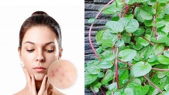 Mengenal Tanaman Herbal Binahong dan Manfaatnya Sebagai Penyembuh Jerawat