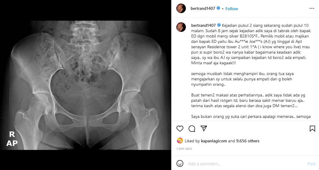 Kondisi terkini adik Bertrand