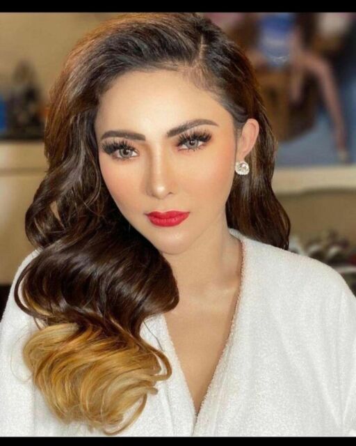 Ayu Aulia operasi angkat rahim