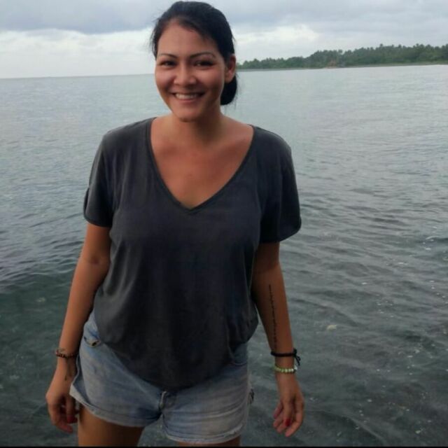 Melanie Subono operasi angkat rahim
