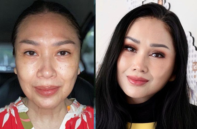 Titi DJ Blak-blakan Soal Operasi Anti Aging, Bikin Penampilanya Lebih Muda