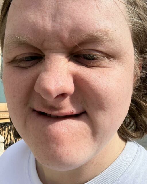 Lewis Capaldi