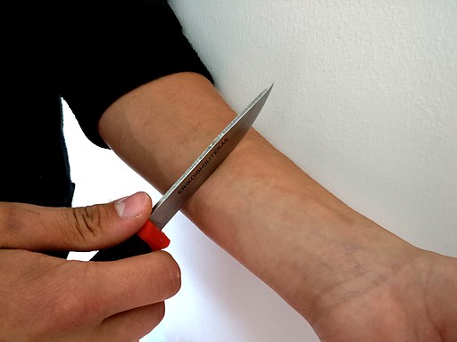 Self harm: Menyakiti Diri