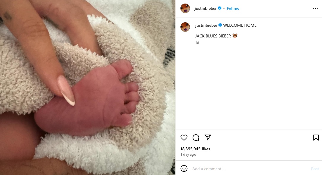 Hailey Baldwin Melahirkan, Justin Bieber Akhirnya Resmi Jadi Ayah. Selamat! 3 Hailey Baldwin Melahirkan, Justin Bieber Akhirnya Resmi Jadi Ayah. Selamat!