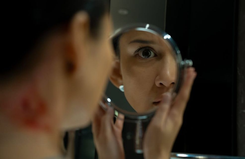 Luka pertama di leher yang di dapat oleh Milla