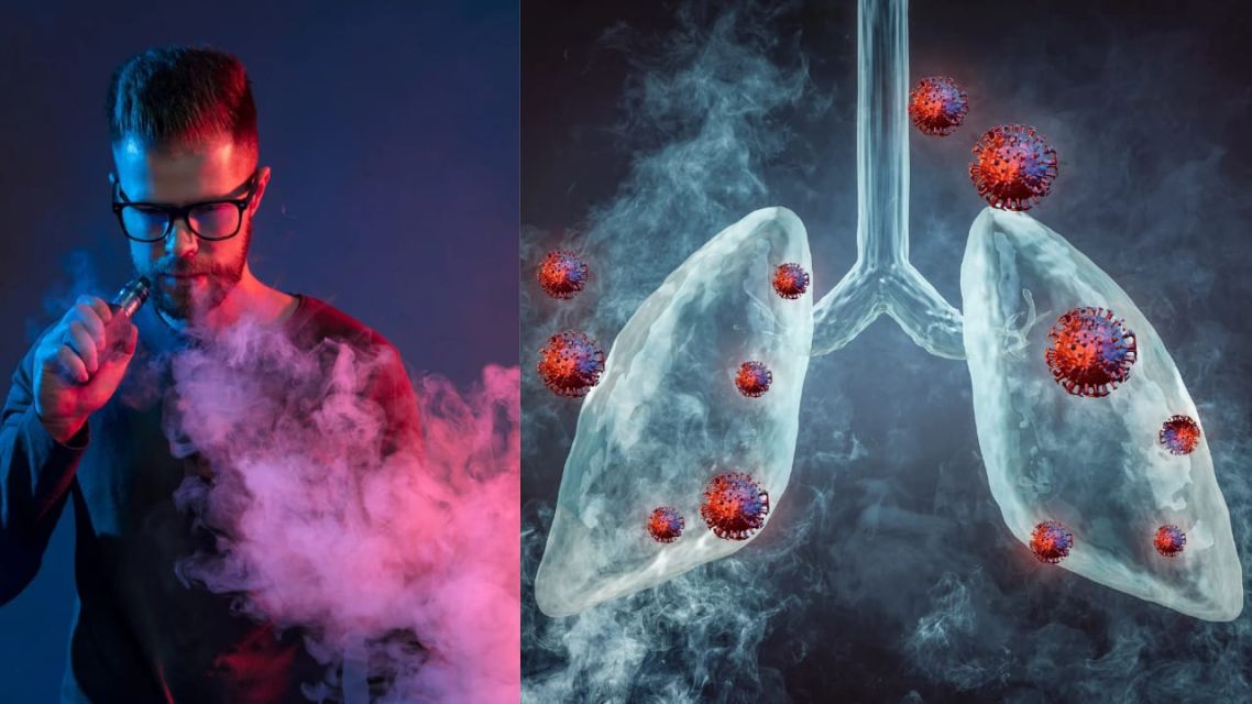 Vape setara narkoba-merusak paru-paru lebih licik