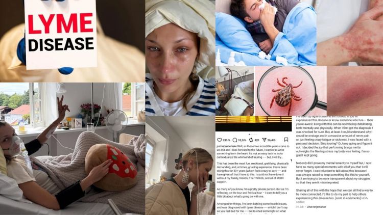 5 Fakta Mengejutkan Seputar Lyme Disease Bella Hadid yang Wajib Diketahui Sebagai Bentuk Awareness
