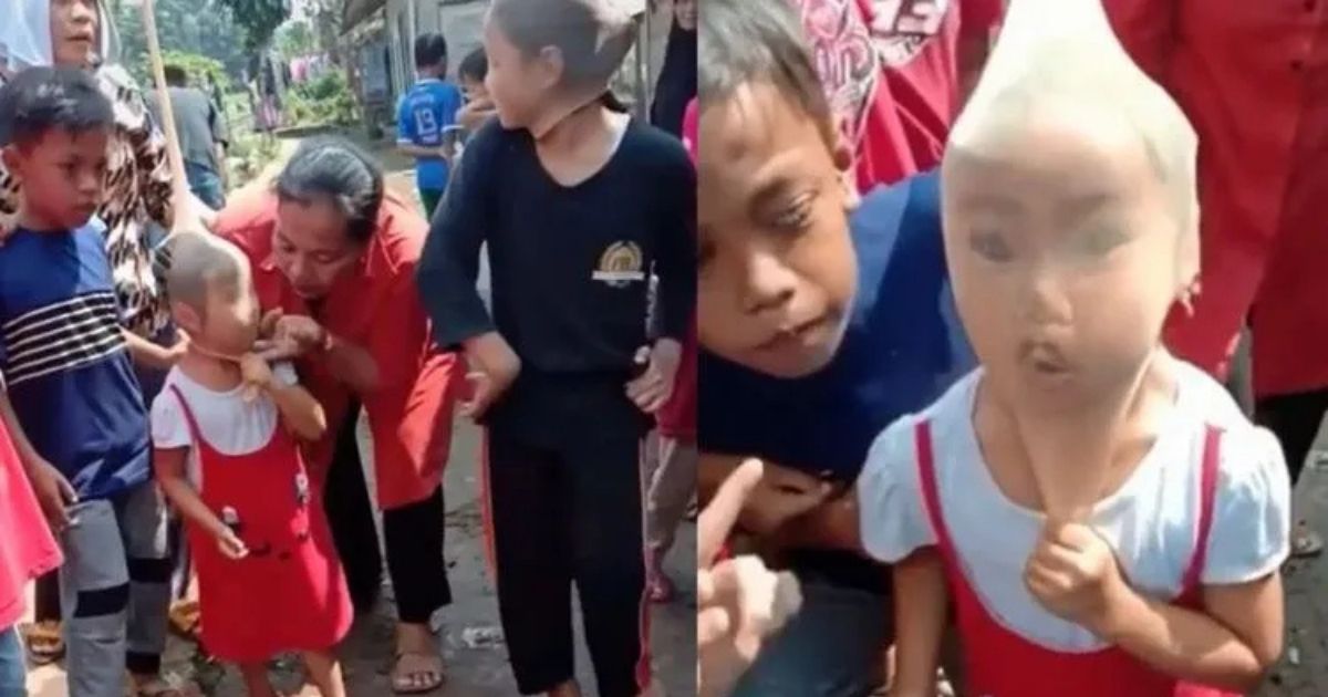Ide Unik Lomba Anak-Anak 17 Agustus yang Antimainstream, Lucu, dan Bikin Ngakak 19 hipwee-Lomba Tiup Lilin Pakai Stocking di Kepala