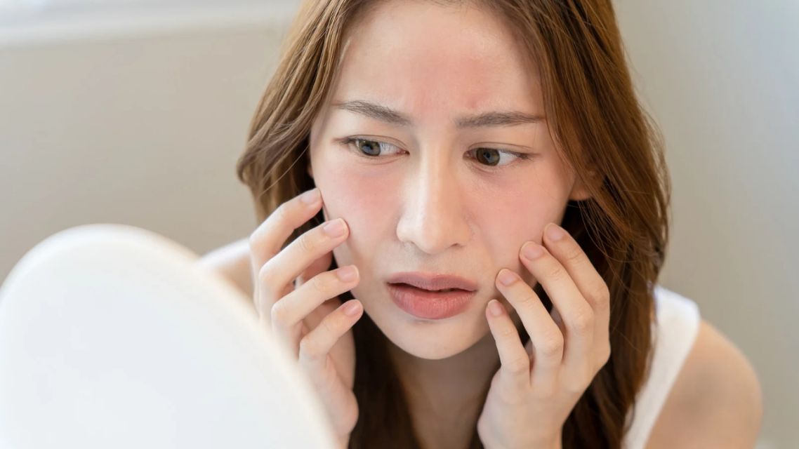 30+ Glosarium Skincare dan Arti Kandungannya. Biar Nggak Salah Pilih 8 Glosarium skincare (25)