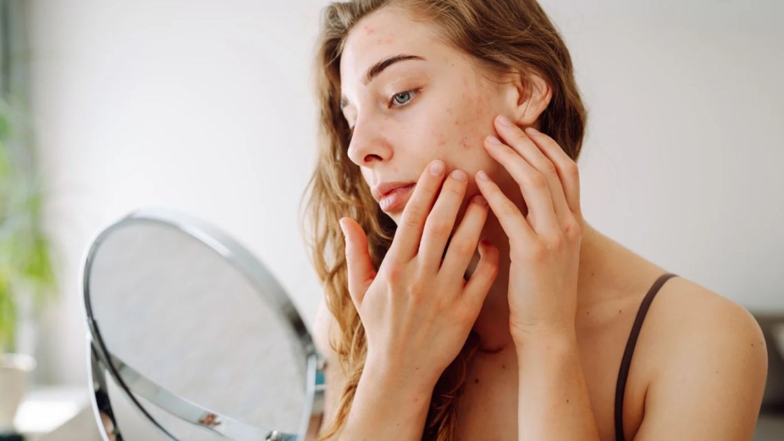 Micellar Water vs Cleansing Balm, Mana yang Lebih Cocok untuk Kulitmu? 17 Micellar water vs cleansing balm (4)
